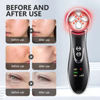 LED Photon Beauty Therapy Device