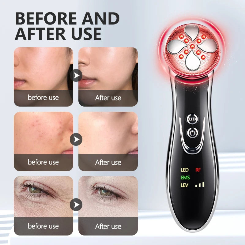 LED Photon Beauty Therapy Device